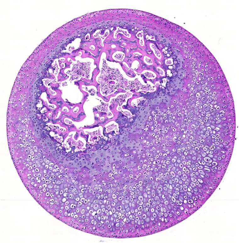Histology slide of bone marrow